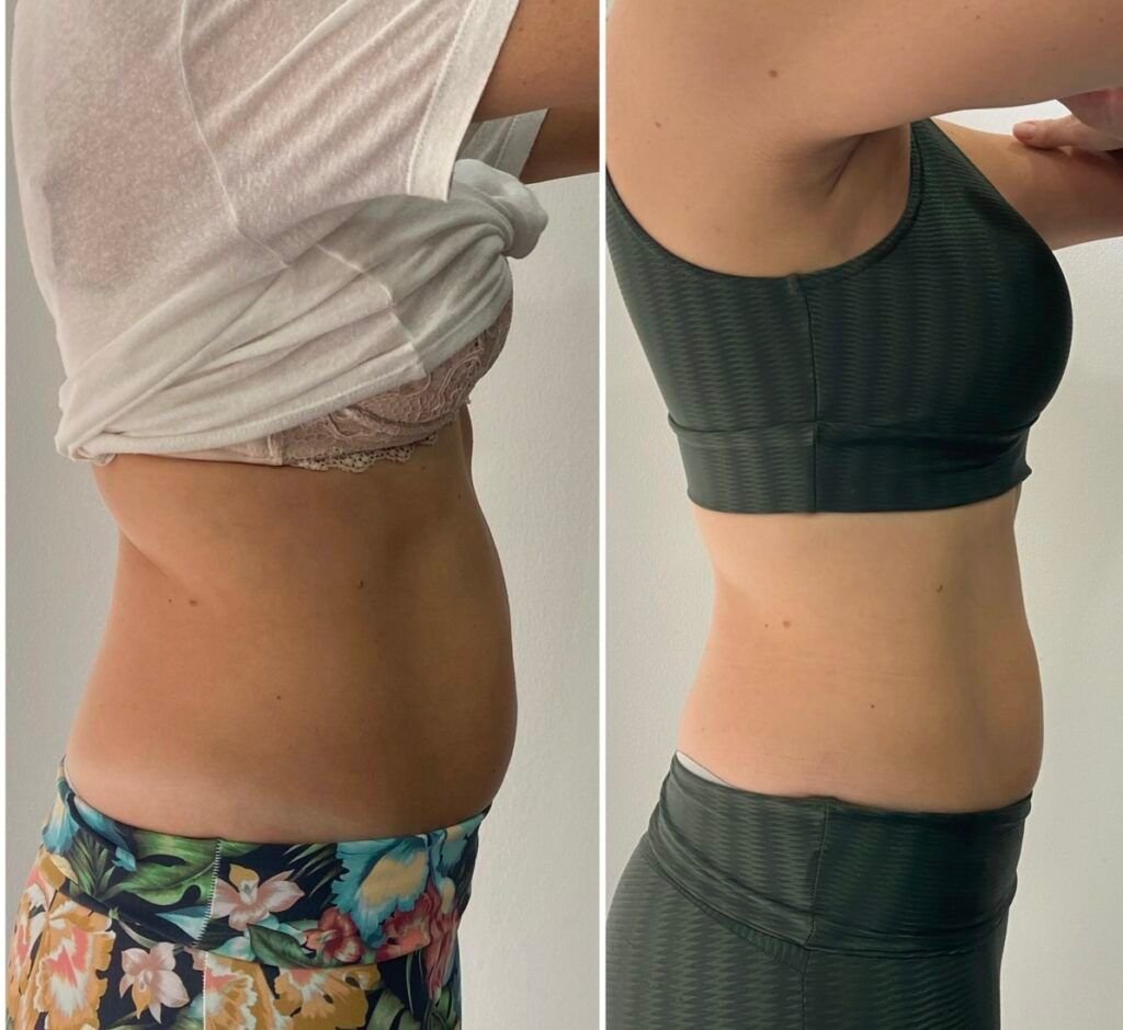 Imagen de WhatsApp 2025-08-08 a las 10.38.56_126de734